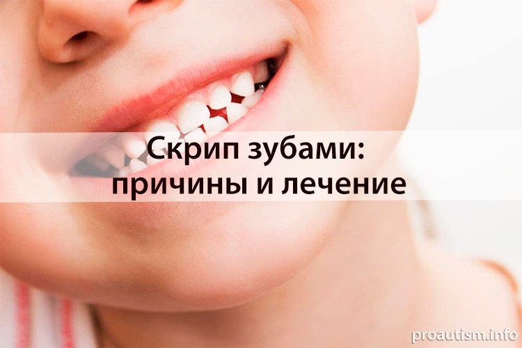 Скрипение зубами - причины и лечение бруксизма